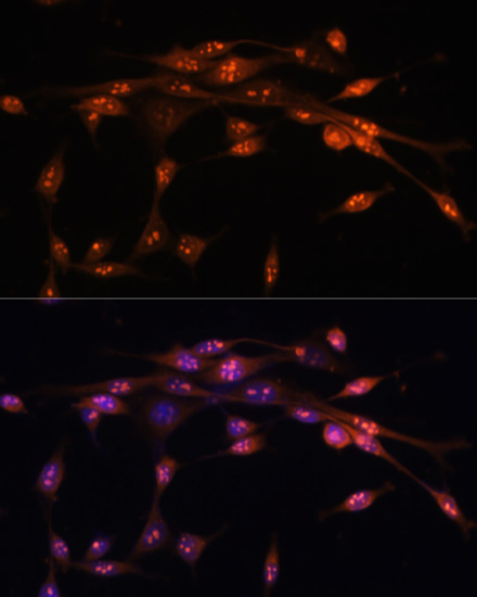 ATR Rabbit Polyclonal Antibody - Image 2