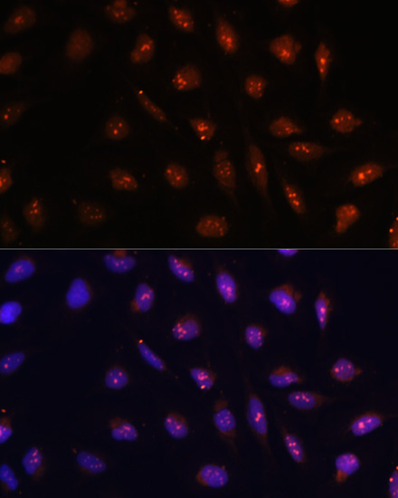 ATR Rabbit Polyclonal Antibody - Image 3