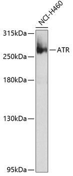 ATR Rabbit Polyclonal Antibody