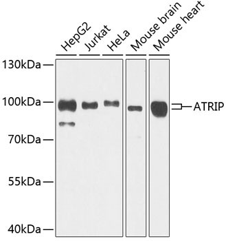 ATRIP Rabbit Polyclonal Antibody