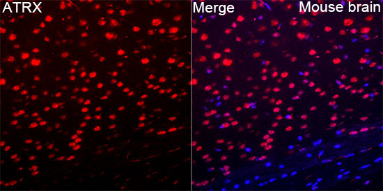 ATRX Rabbit Polyclonal Antibody