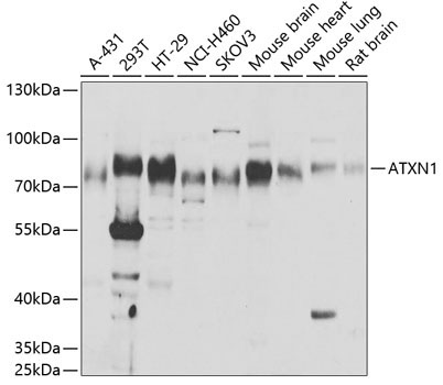 ATXN1 Rabbit Polyclonal Antibody