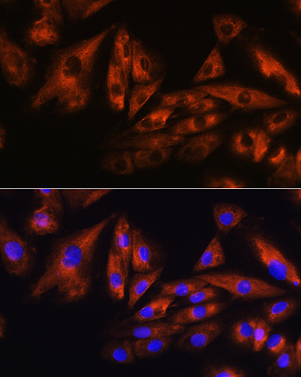 ATXN10 Rabbit Polyclonal Antibody - Image 2