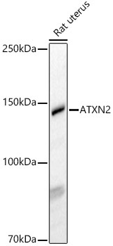 ATXN2 Rabbit Polyclonal Antibody