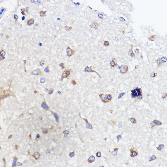 ATXN2 Rabbit Polyclonal Antibody - Image 2
