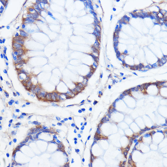 ATXN2 Rabbit Polyclonal Antibody - Image 3
