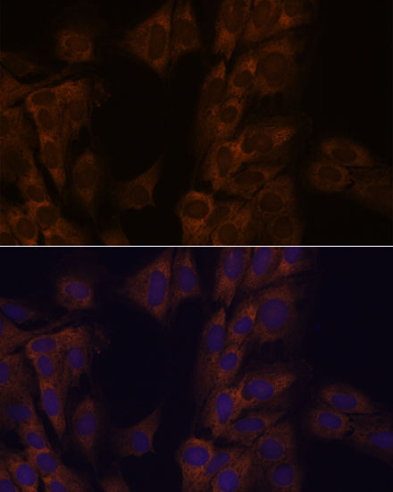 ATXN2 Rabbit Polyclonal Antibody - Image 4