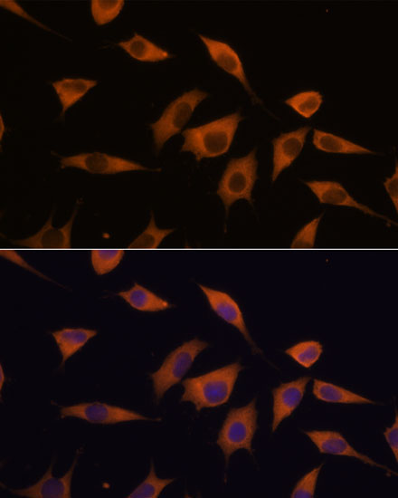 ATXN2 Rabbit Polyclonal Antibody - Image 5