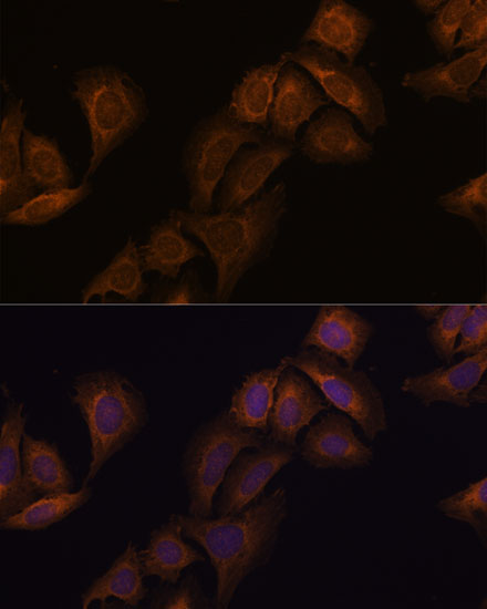 ATXN2 Rabbit Polyclonal Antibody - Image 6