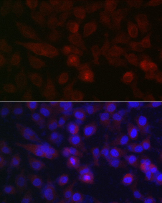 AURKA Rabbit Polyclonal Antibody - Image 2