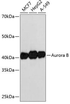 Aurora B Rabbit Monoclonal Antibody