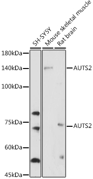 AUTS2 Rabbit Polyclonal Antibody