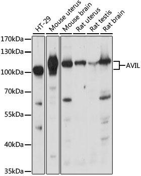 AVIL Rabbit Polyclonal Antibody