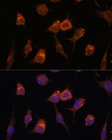 AVIL Rabbit Polyclonal Antibody - Image 2