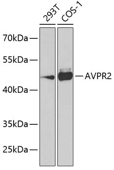 AVPR2 Rabbit Polyclonal Antibody