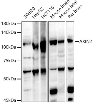 AXIN2 Rabbit Polyclonal Antibody