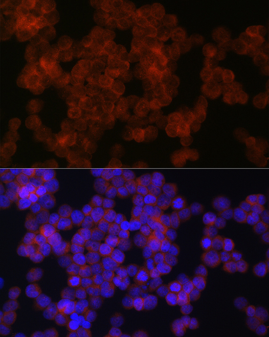 AXIN2 Rabbit Polyclonal Antibody