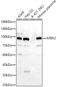AXIN2 Rabbit Polyclonal Antibody