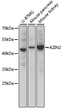 AZIN2 Rabbit Polyclonal Antibody