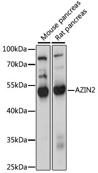 AZIN2 Rabbit Polyclonal Antibody