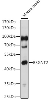 B3GNT2 Rabbit Polyclonal Antibody