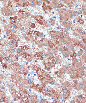 B3GNT3 Rabbit Polyclonal Antibody - Image 2