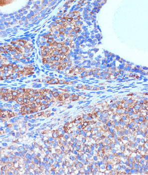 B3GNT3 Rabbit Polyclonal Antibody - Image 3