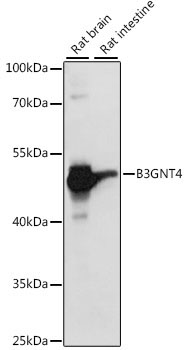 B3GNT4 Rabbit Polyclonal Antibody