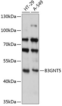 B3GNT5 Rabbit Polyclonal Antibody