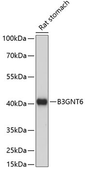 B3GNT6 Rabbit Polyclonal Antibody