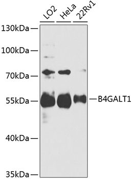 B4GALT1 Rabbit Polyclonal Antibody
