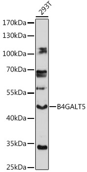 B4GALT5 Rabbit Polyclonal Antibody