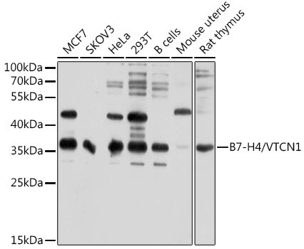 B7-H4/VTCN1 Rabbit Polyclonal Antibody