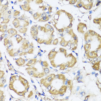 B9D1 Rabbit Polyclonal Antibody - Image 2
