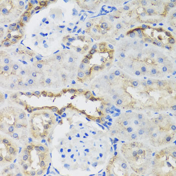 B9D1 Rabbit Polyclonal Antibody - Image 3