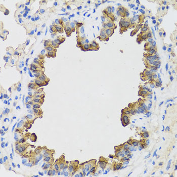 B9D1 Rabbit Polyclonal Antibody - Image 4