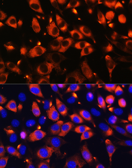 B9D1 Rabbit Polyclonal Antibody - Image 5