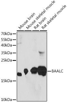 BAALC Rabbit Polyclonal Antibody