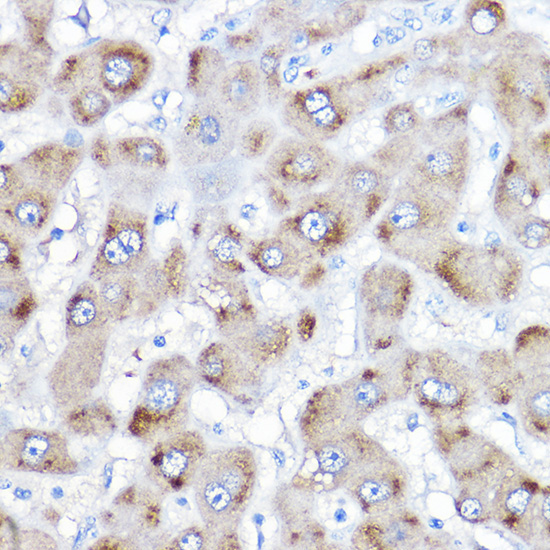 BAAT Rabbit Polyclonal Antibody - Image 2