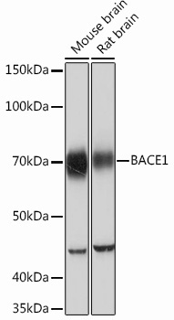 BACE1 Rabbit Monoclonal Antibody