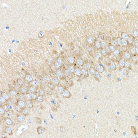 BACE1 Rabbit Polyclonal Antibody - Image 2