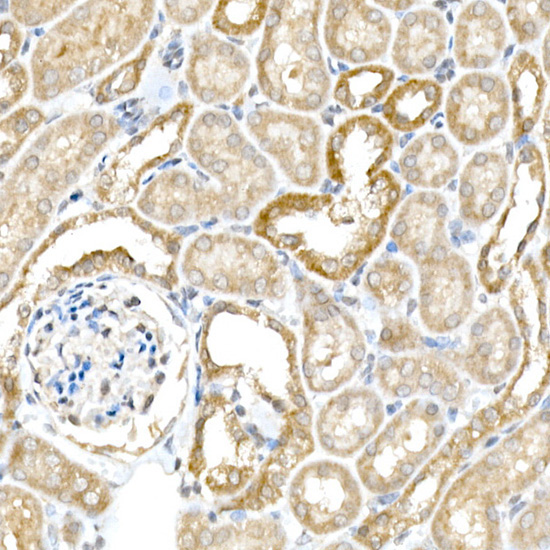 BACE1 Rabbit Polyclonal Antibody - Image 3