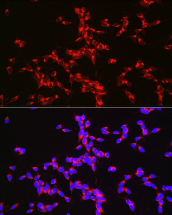 BACE1 Rabbit Polyclonal Antibody - Image 4