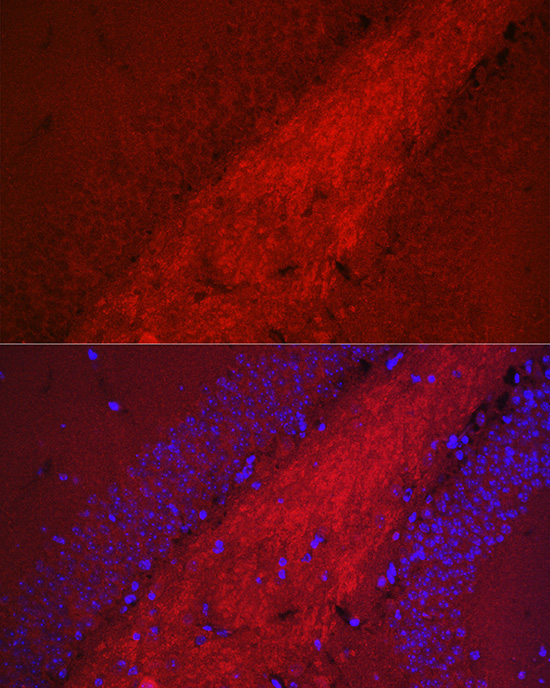 BACE1 Rabbit Polyclonal Antibody - Image 5