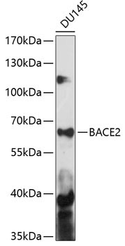 BACE2 Rabbit Polyclonal Antibody