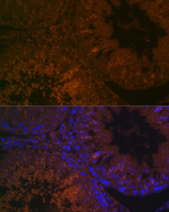 BACE2 Rabbit Polyclonal Antibody - Image 2