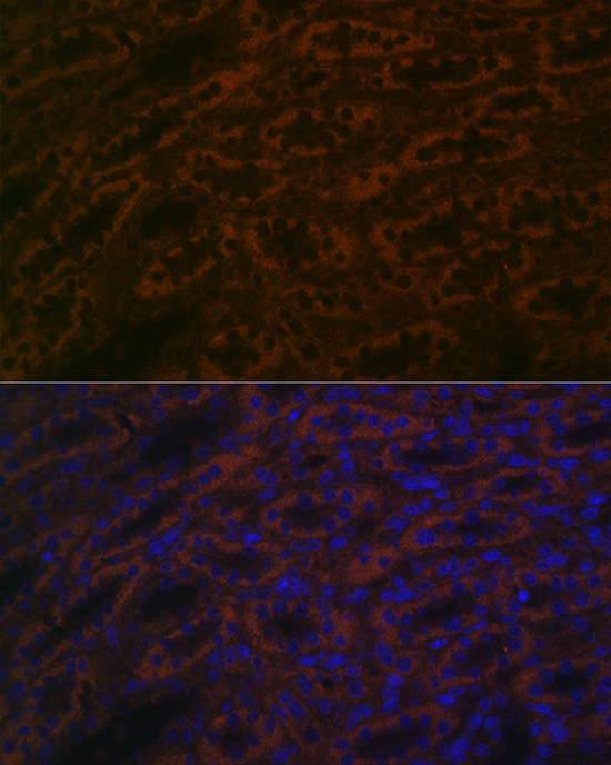 BACE2 Rabbit Polyclonal Antibody - Image 3