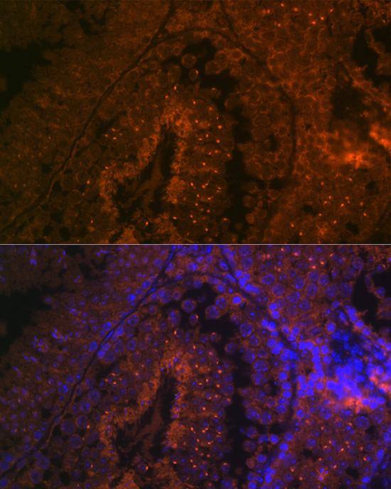BACE2 Rabbit Polyclonal Antibody - Image 4