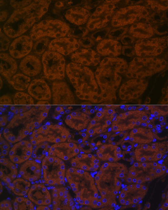 BACE2 Rabbit Polyclonal Antibody - Image 5