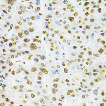 BAF57/SMARCE1 Rabbit Polyclonal Antibody - Image 2